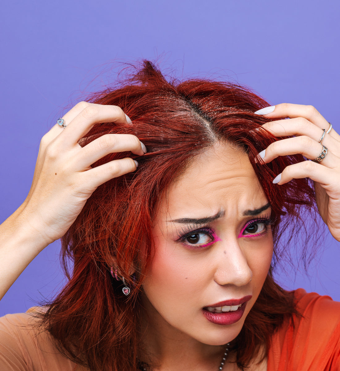 How to Get Rid of Dandruff? Explore the Dandruff Treatments Available