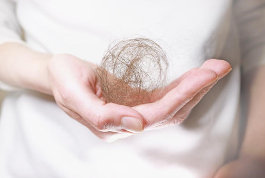 Coping with Alopecia Hair Loss Conditions | Venusde Malaysia